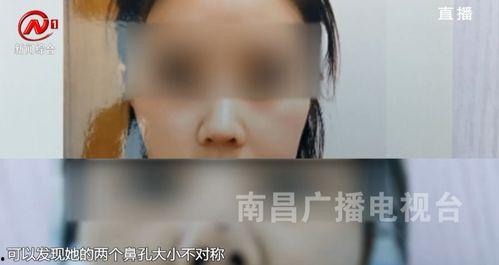 南昌医美爆料事件视频播放,揭秘行业乱象